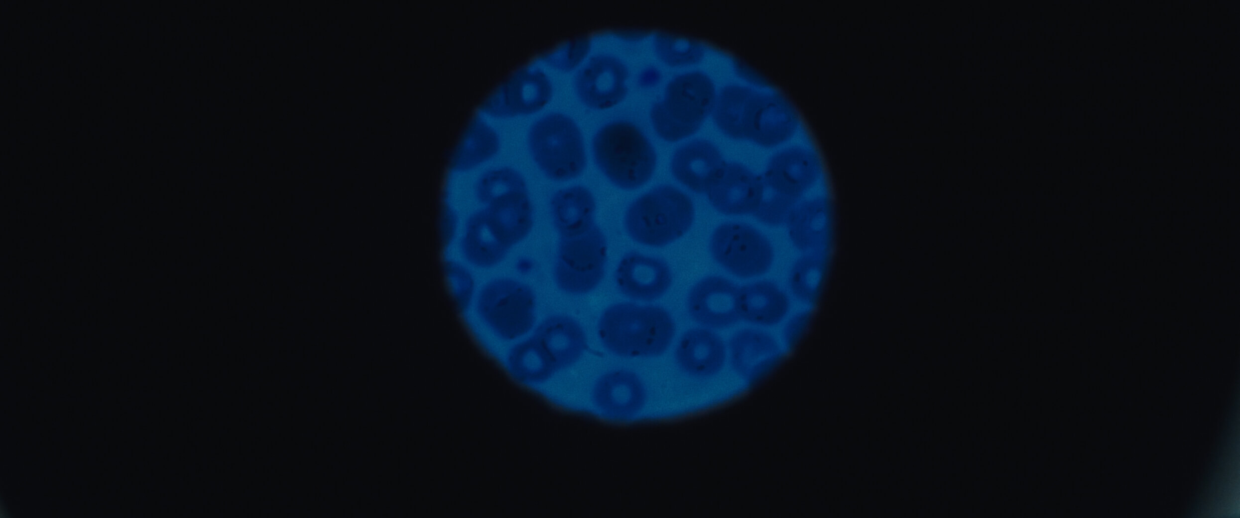 Behind the scenes — Ryann's Story for RMHC, directed by Martin Marko